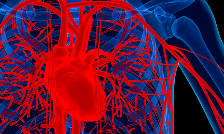 Investigational Extravascular ICD System Heart Failure Foundation